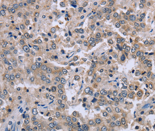 EID1 Polyclonal Antibody (E-AB-14978)
