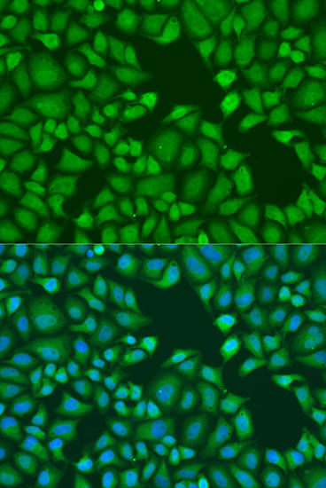 TNRC6A Polyclonal Antibody (E-AB-63096)