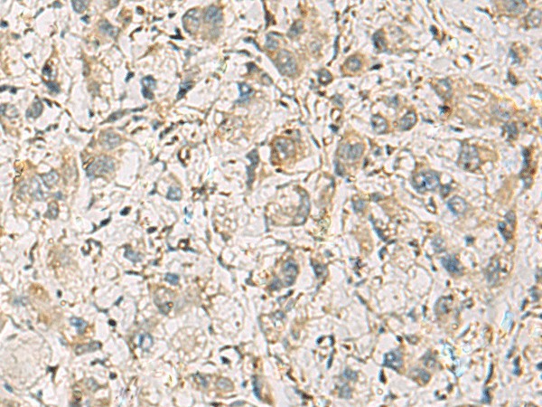 CMTM1 Polyclonal Antibody (E-AB-19277)