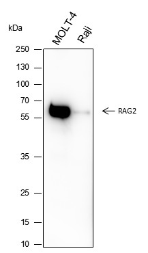Recombinant RAG2 Monoclonal Antibody (AN301647L)