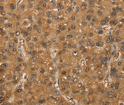 SETD2 Polyclonal Antibody (E-AB-14627)