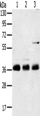 ANKRD1 Polyclonal Antibody (E-AB-10801)