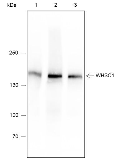 Recombinant WHSC1 Monoclonal Antibody (AN301885L)