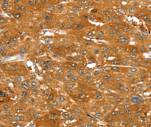 ABCC9 Polyclonal Antibody (E-AB-16894)