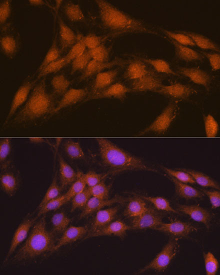 (KO Validated) NRBF2 Polyclonal Antibody (E-AB-61982)