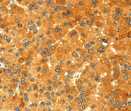 GK1 Polyclonal Antibody (E-AB-11273)