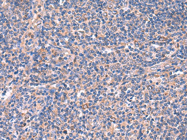 MPP1 Polyclonal Antibody (E-AB-19053)
