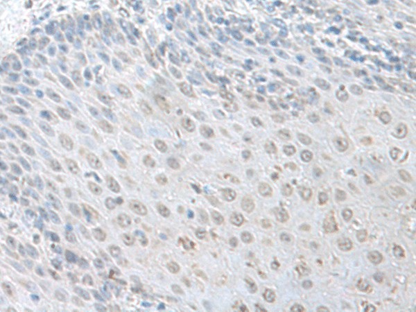 LSM10 Polyclonal Antibody (E-AB-52682)