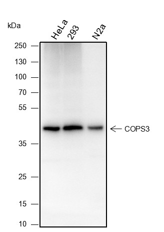 Recombinant COPS3 Monoclonal Antibody (AN301497L)