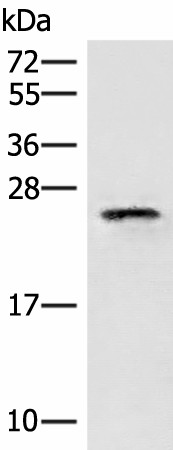 EIF3K Polyclonal Antibody (E-AB-18944)