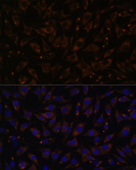 PLLP Polyclonal Antibody (E-AB-66601)