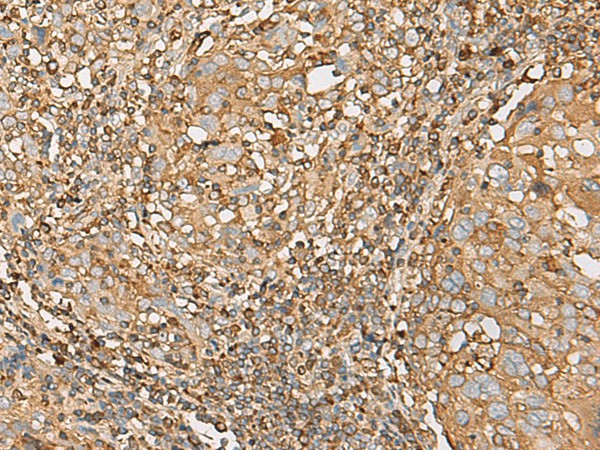 UBE2A Polyclonal Antibody (E-AB-52693)