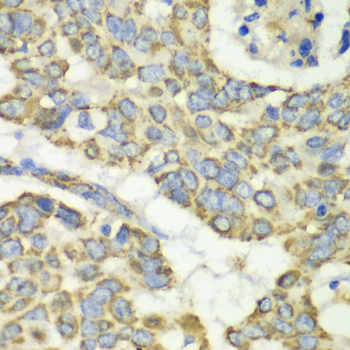 TUFM Polyclonal Antibody (E-AB-61951)