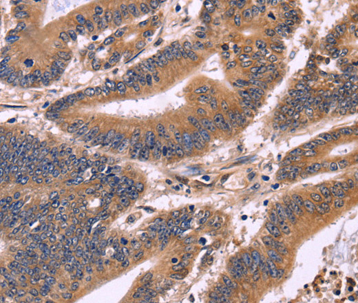 S100A13 Polyclonal Antibody (E-AB-14337)