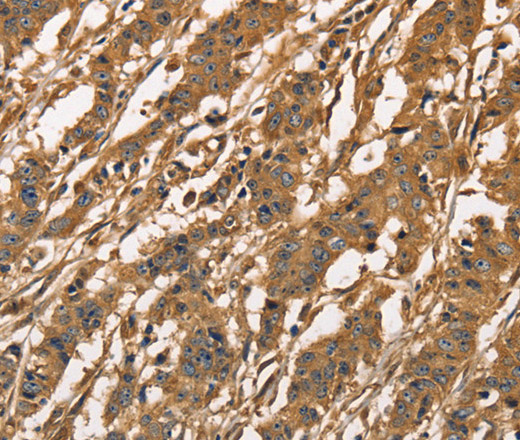 CAPZA3 Polyclonal Antibody (E-AB-14821)