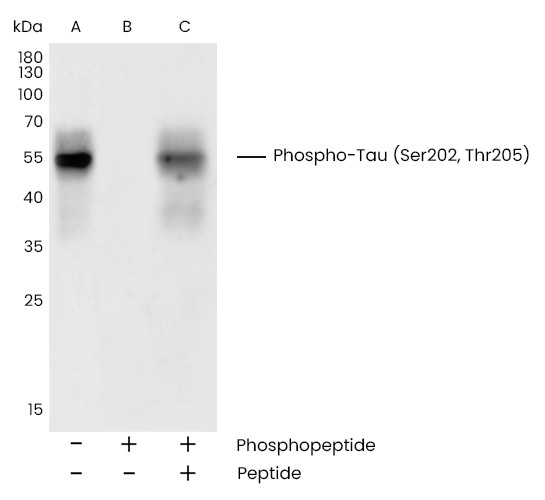 Recombinant Phospho-Tau (Ser202, Thr205) Monoclonal Antibody (AN300378L)