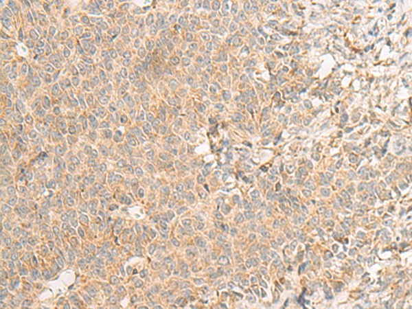 RNF207 Polyclonal Antibody (E-AB-17970)