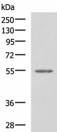 SLC16A1 Polyclonal Antibody (E-AB-53264)