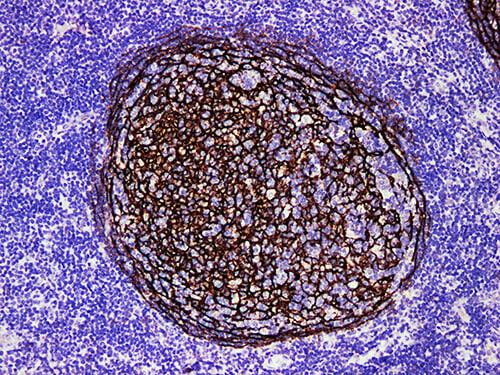 CD21 Monoclonal Antibody (ELAB6013-M)