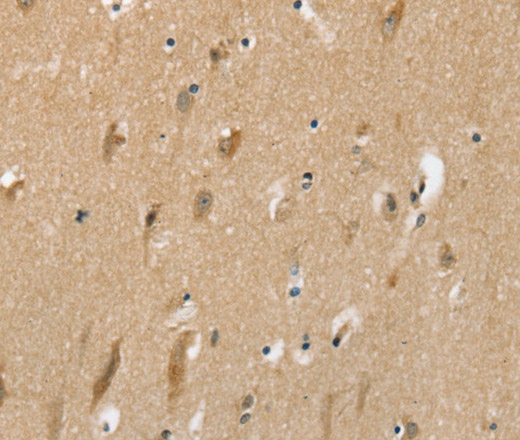 SLC6A7 Polyclonal Antibody (E-AB-16846)