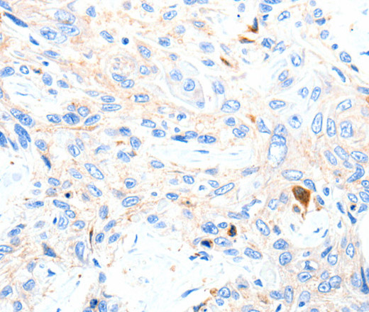 P2RY1 Polyclonal Antibody (E-AB-12606)