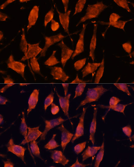 XPNPEP3 Polyclonal Antibody (E-AB-66369)
