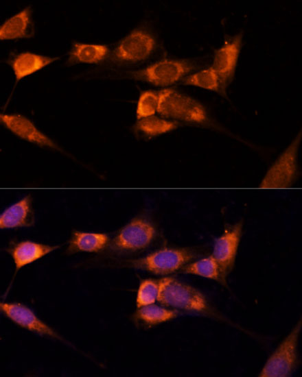 TXNDC12 Polyclonal Antibody (E-AB-64996)