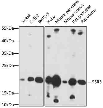 SSR3 Polyclonal Antibody (E-AB-91946)