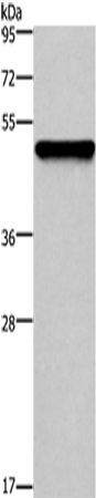 CK-14 Polyclonal Antibody (E-AB-12322)
