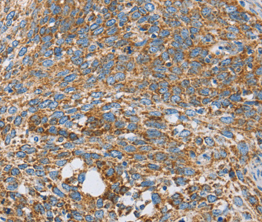 CENPO Polyclonal Antibody (E-AB-11070)