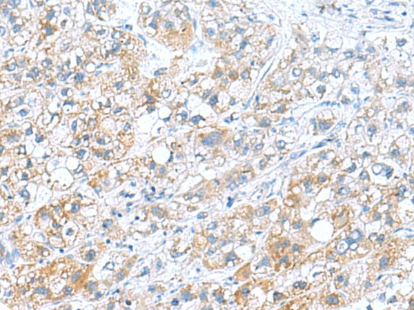 DNAL1 Polyclonal Antibody (E-AB-19131)