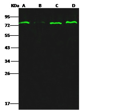 Recombinant ER alpha/ESR1 Monoclonal Antibody (AN300296P)
