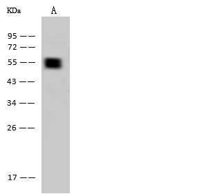 Recombinant Cytokeratin 7/KRT7 Monoclonal Antibody (AN300110P)