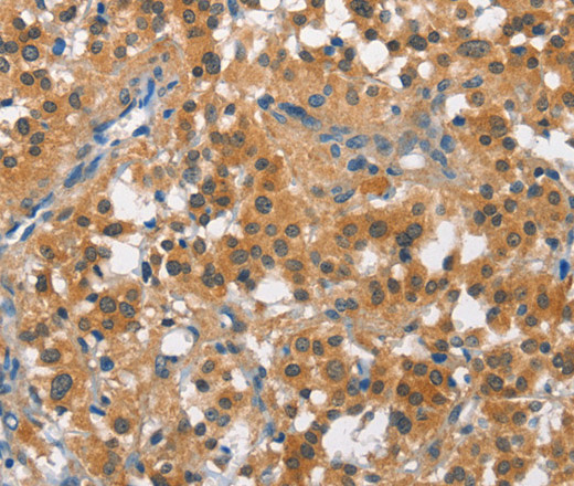 CUL7 Polyclonal Antibody (E-AB-10264)