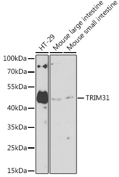 TRIM31 Polyclonal Antibody (E-AB-90228)
