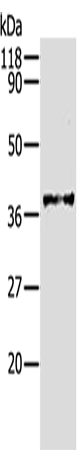 AKR1B1 Polyclonal Antibody (E-AB-13799)