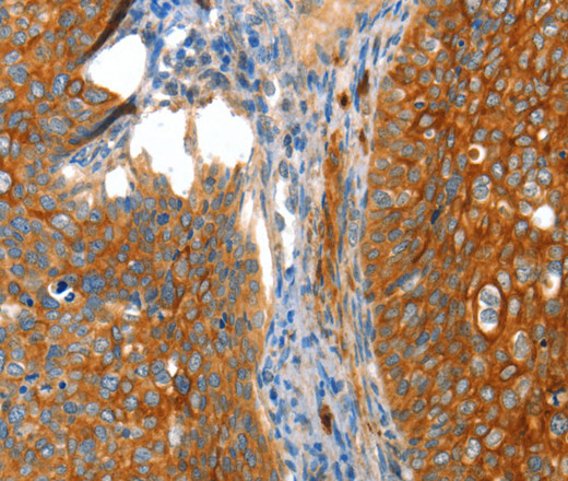 VWA5A Polyclonal Antibody (E-AB-10998)