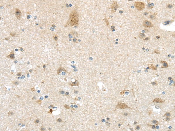 VSIG10 Polyclonal Antibody (E-AB-17553)
