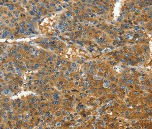 TNFSF13B Polyclonal Antibody (E-AB-13947)