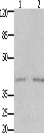 GFRA3 Polyclonal Antibody (E-AB-12469)