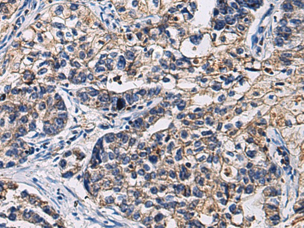 SSH3 Polyclonal Antibody (E-AB-53152)
