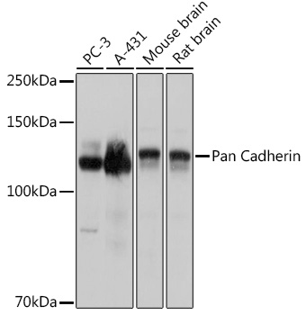 Pan Cadherin Polyclonal Antibody (E-AB-92116)