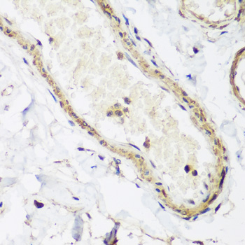 CAV3 Polyclonal Antibody (E-AB-62653)