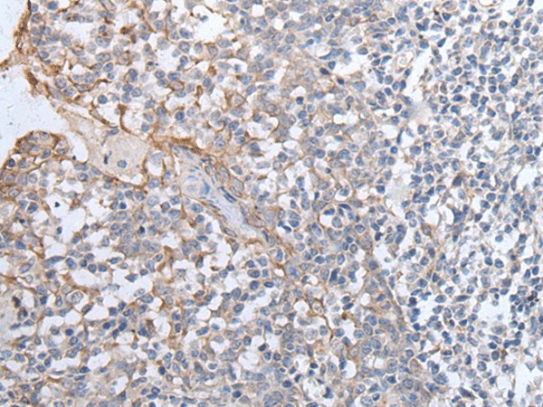 GPD2 Polyclonal Antibody (E-AB-19535)