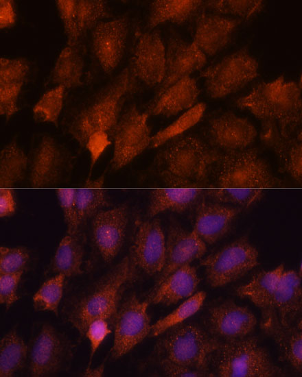 SMYD3 Polyclonal Antibody (E-AB-65021)