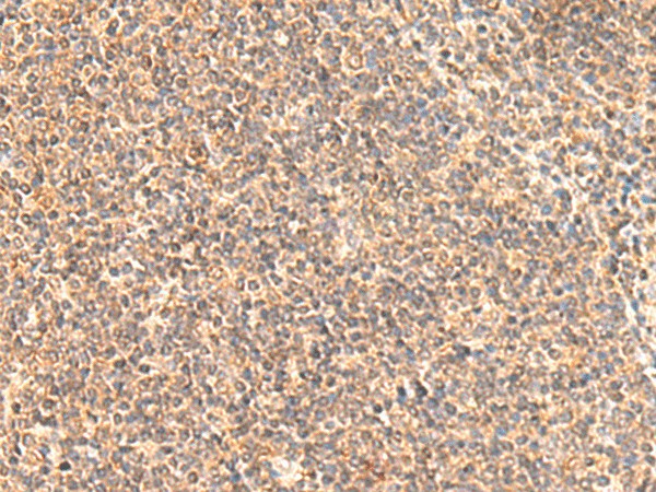 MOB1A Polyclonal Antibody (E-AB-18943)