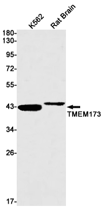 Recombinant Transmembrane Protein 173 Monoclonal Antibody (E-AB-81615)