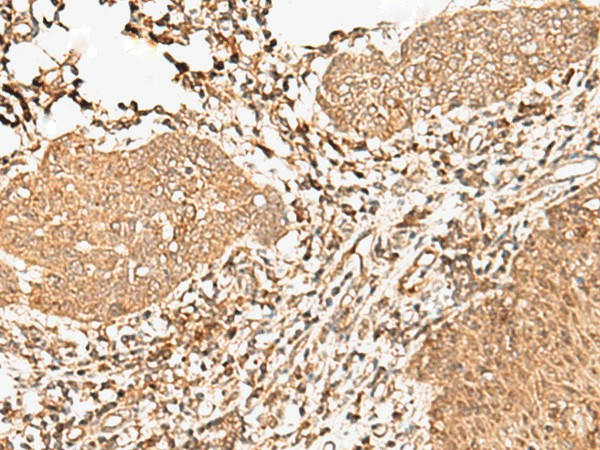 FER Polyclonal Antibody (E-AB-17958)