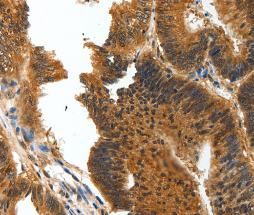 BIRC6 Polyclonal Antibody (E-AB-12890)