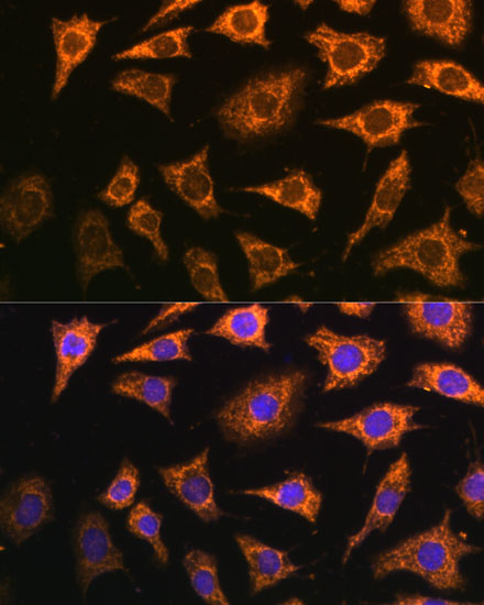 PDHA2 Polyclonal Antibody (E-AB-65173)